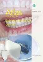 Atlas_terap__utico_de_blanqueamiento_dental